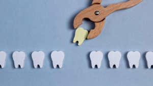 What to Avoid After Tooth Extraction