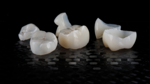 What are Dental Crowns Made of